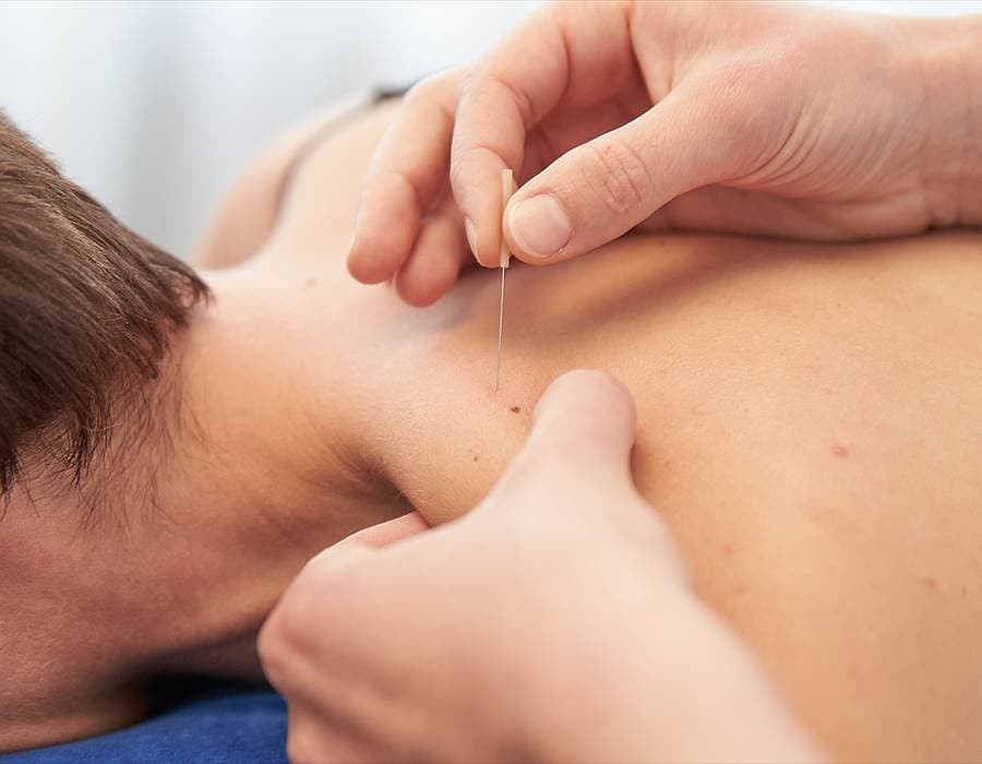Dry Needling & Cupping